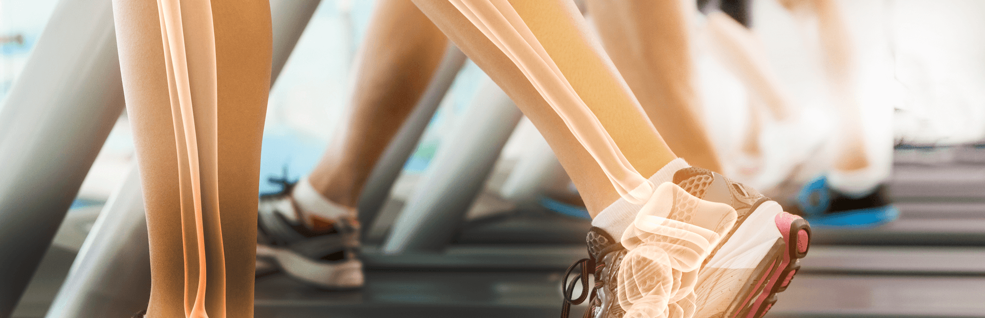 legs bones on treadmill trucal logo