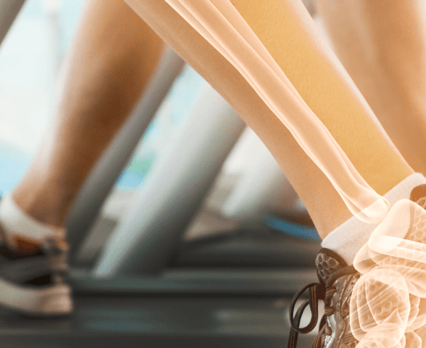 legs bones on treadmill trucal logo