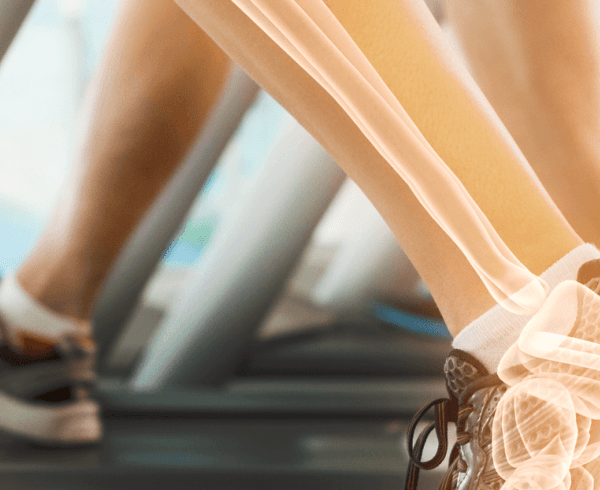 legs bones on treadmill trucal logo